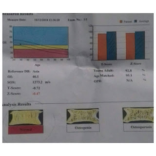 Pemeriksaan Kesihatan Tulang Saya