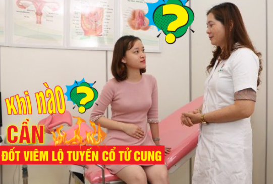 đốt viêm lộ tuyến