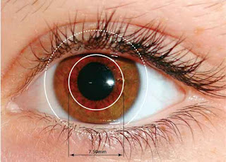 Corneal diameter