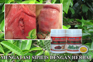 nama antibiotik sipilis | OBAT PENYAKIT KELAMIN AMPUH