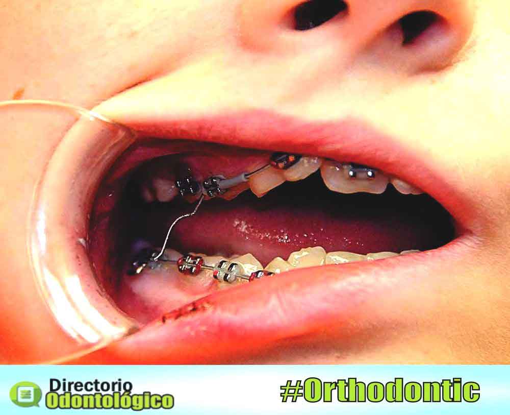 Orthodontics