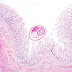 Emultilocularis Appearence In Stool