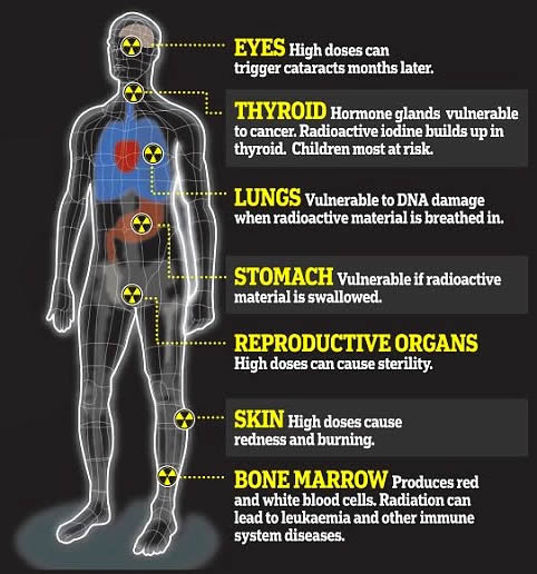 Radiation effect on health