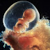 18 Week Fetus Development