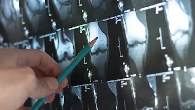 X-rays-Can-help-detect-bone-abnormalities-or-fractures.
