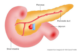 pancreas,amilasa,hemocromatosis,ferritina alta