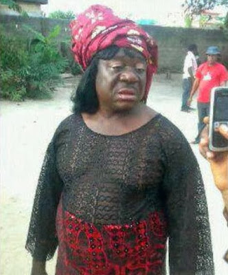 Please who did this to Mr. Ibu, aka John Okafor? (See Photos)