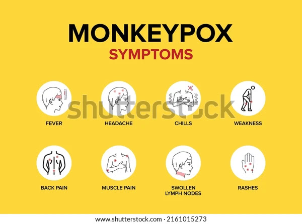 Monkeypox outbreak, monkeypox symptoms, monkeypox cases, Causes of monkeypox, monkeypox treatment, monkeypox disease