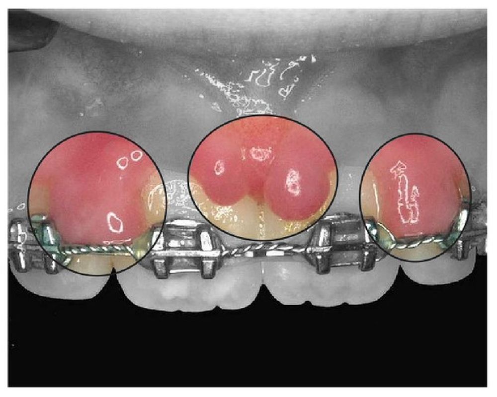 ORTHODONTICS