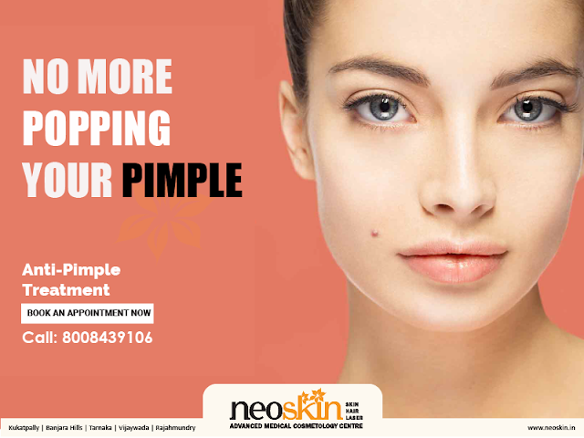 Neoskin Pimple Removal