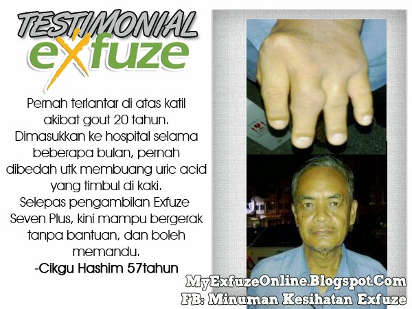 My Exfuze Online: Supplement, Kesihatan, Perniagaan 