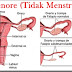 Mengatasi Amenore (Tidak Menstruasi) Secara Alami