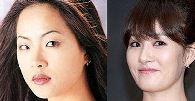 Kim Sun Ah Before After