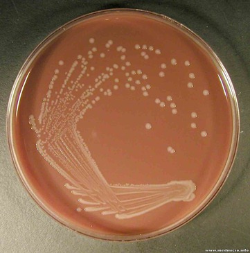 Haemophilus spp.