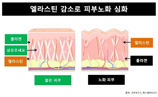 엘라스틴감소-피부노화