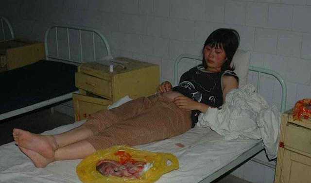 Mãe junto a seu bebê abortado pela força na China comunista