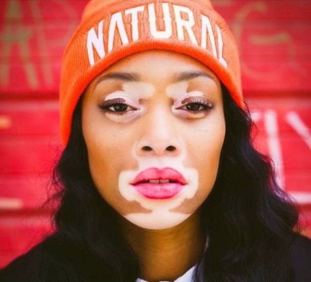 Winnie Harlow