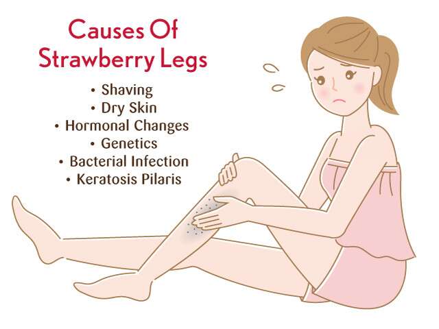 Smooth and Silky Say Goodbye to Strawberry Legs with Expert Tips and Techniques!