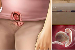 Contoh Keputihan Tanda Hamil 1 Minggu dan Ciri-ciri Tanda Awal Kehamilan