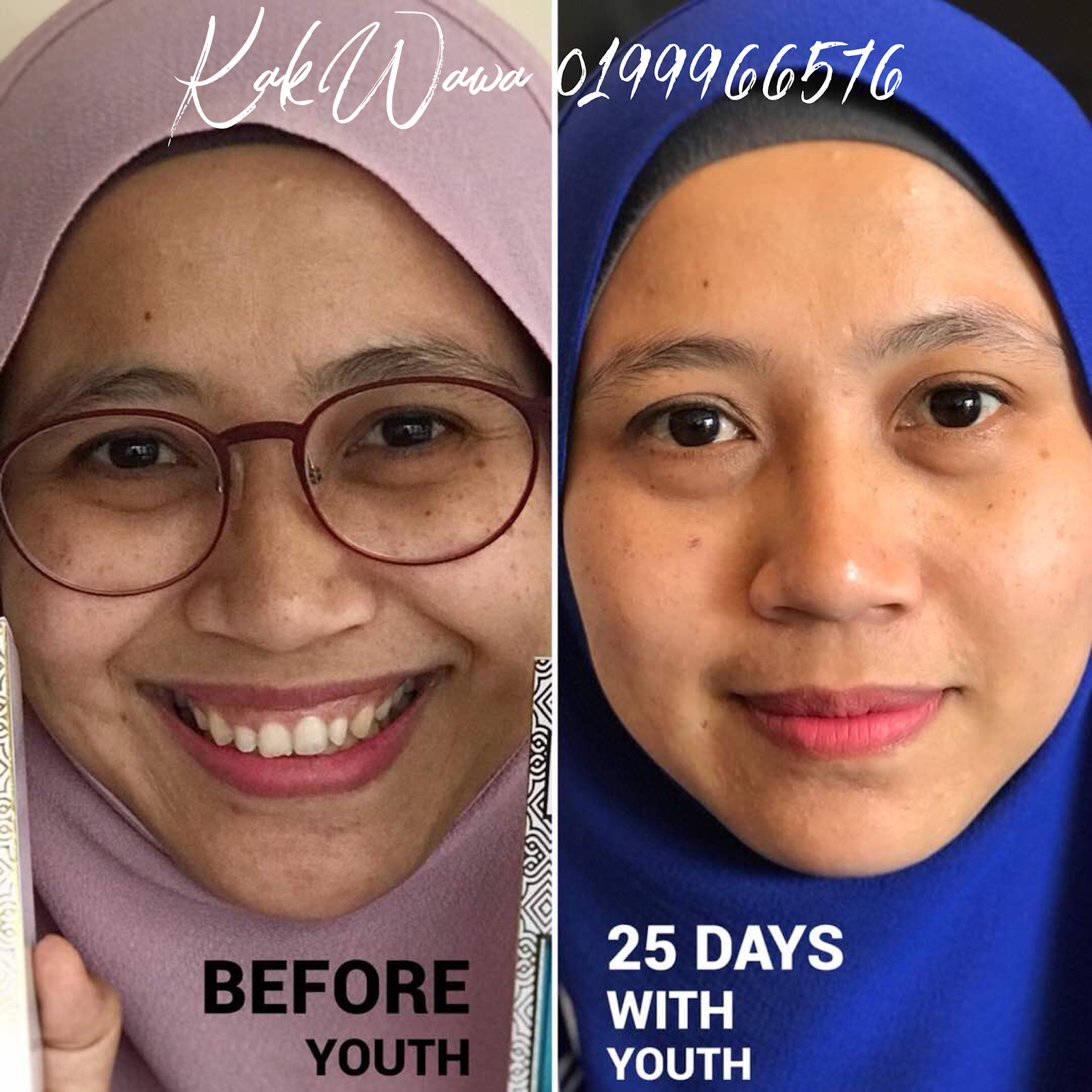 Testimoni Youth Skincare Shaklee Terbaru - KAK WAWA 