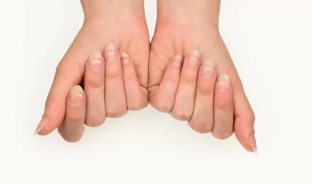 Home remedies to strengthen nails
