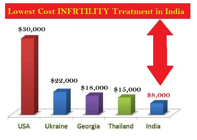 Low COST infertility Treatment in India