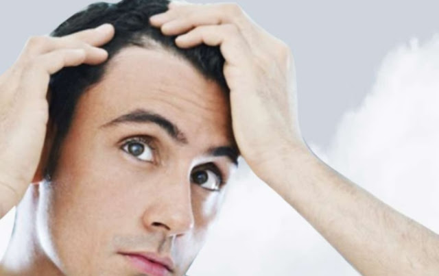Hair Transplant: Types And Advantages