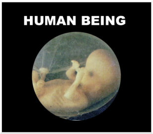 a fetus is a human being