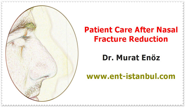 Nasal fracture definition - Broken nose - Nasal fracture symptoms - Nasal fracture diagnosis - Nasal fracture treatment - Nasal fracture reduction - Treatment for a broken nose - The treatment of nasal fractures - Open nasal fracture repair - Post-operative instructions for reduction nasal fracture