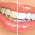 The Dangers Of illegal Tooth Whitening And Its Terrible Side Effects