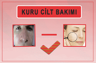  Cilt Kuruluğu Nasıl Giderilir