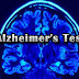 Αλτσχάιμερ: Τεστ 10 ερωτήσεων που δείχνει αν θα έχετε πρόβλημα