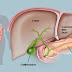 Cukup dengan 1 Sendok Saja Ramuan Ajaib Ini Sudah Cukup untuk Bersihkan Liver Anda!!!Silahkan Bantu Sebarkan Ya...