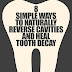8 Simple Ways to Naturally Reverse Cavities and Heal Tooth Decay