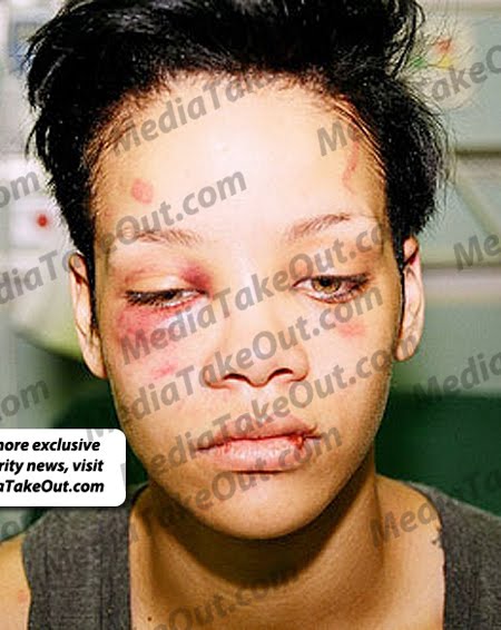 rihanna pictures chris brown beating. Chris Brown is an alleged