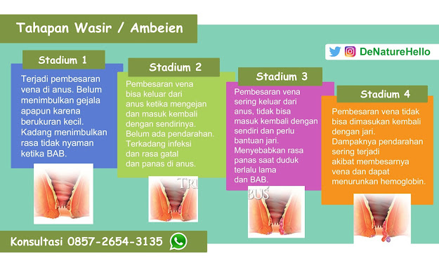 Stadium Wasir Ambeien