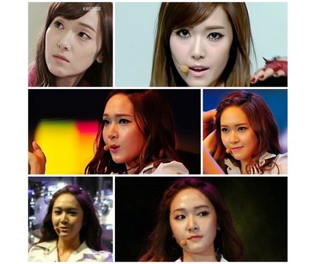 jessica snsd girls generation plastic surgery