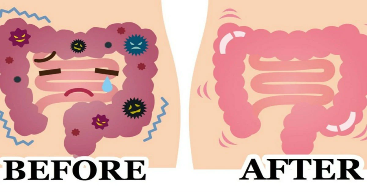  Deflate Your Stomach And Cleanse The Colon
