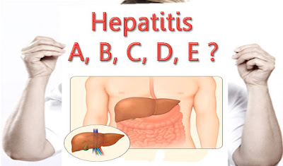 Gejala Dan Penyebab Hepatitis