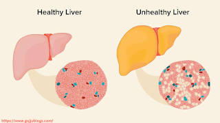 Liver damage symptoms in hindi