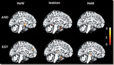 lesbian_brain