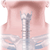 Mediastinoscopy Definition, Inidcations, Anesthesia, Post-OP Care