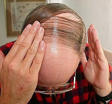 bald men hairstyle