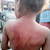 4-year-old girl gets brutally flogged for misplacing her slippers...(photos)