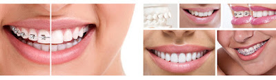 http://www.delhidentalsolutions.co.in