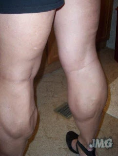 natural muscular female calves fetish