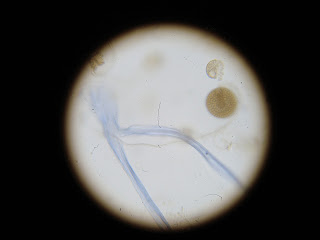 Fungus cells