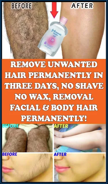 Remove Unwanted Hair Permanently In Three Days, No Shave No Wax, Removal Facial & Body Hair Permanently