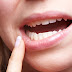 Dấu hiệu nhận biết niềng răng bị sưng lợi