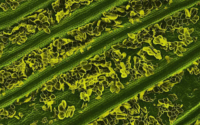 Food Photographed with an Electron Microscope Seen On www.coolpicturegallery.us